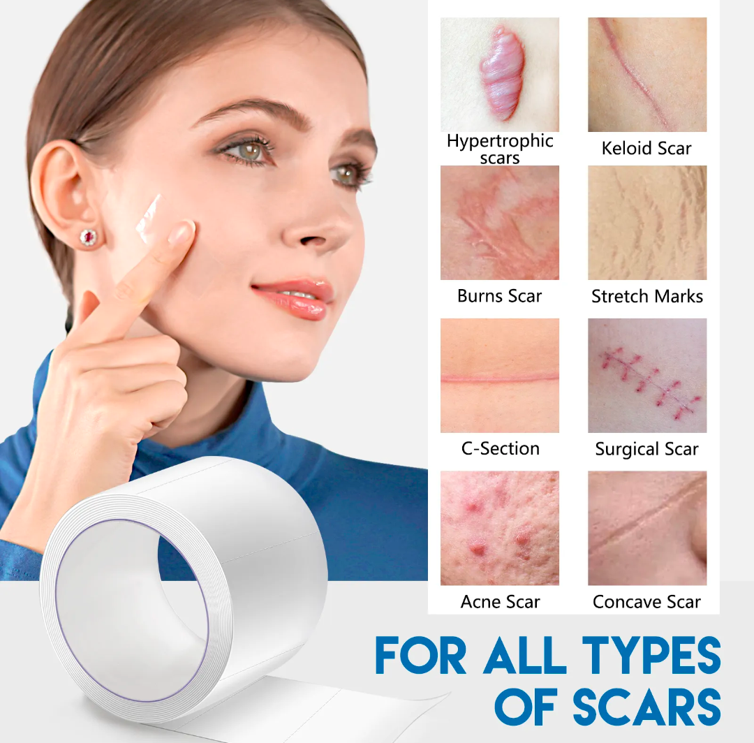 Scar Therapy Medical Grade Silicone Tape